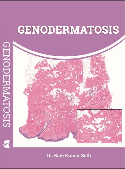 Genodermatosis 