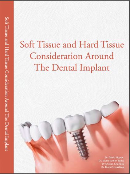 SOFT TISSUE AND HARD TISSUE CONSIDERATION AROUND THE DENTAL IMPLANT