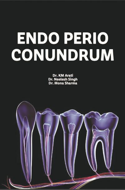 ENDO - PERIO CONUNDRUM