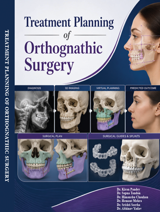 Treatment Planning of Orthognathic Surgery