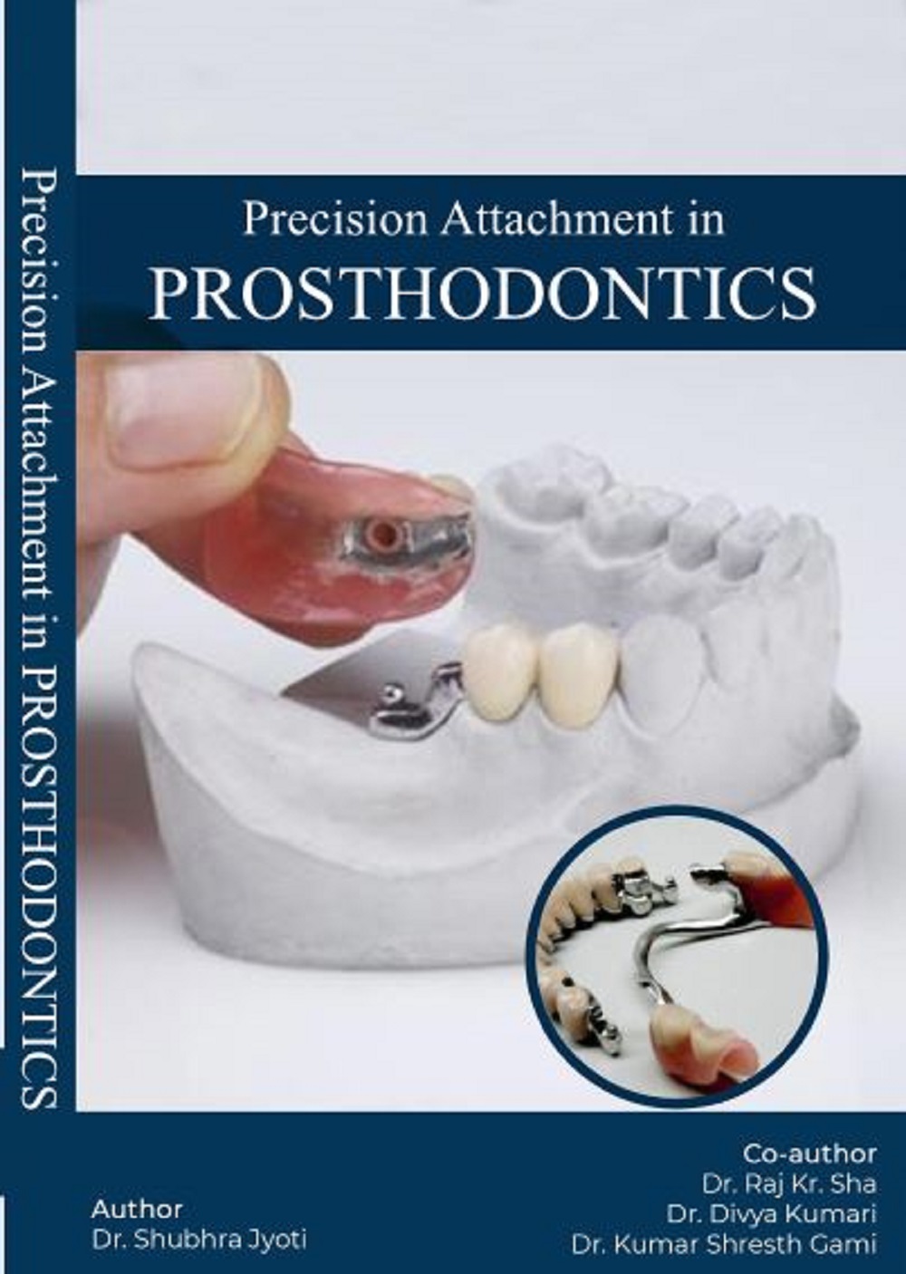 PRECISION ATTACHMENT IN PROSTHODONTICS