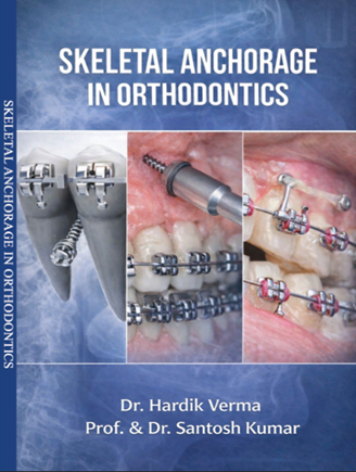 SKELETAL ANCHORAGE IN ORTHODONTICS