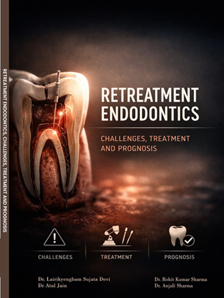 Retreatment Endodontics, Challenges, Treatment and Prognosis