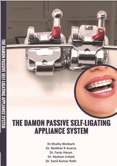 THE DAMON PASSIVE SELF LIGATING APPLIANCE SYSTEM 