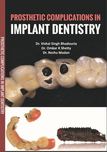 PROSTHETIC COMPLICATIONS IN IMPLANT DENTISTRY 