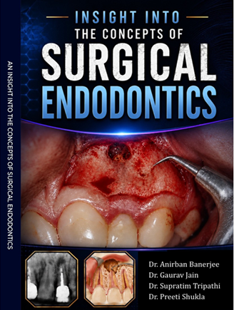 An Insight into the Concepts of Surgical Endodontics