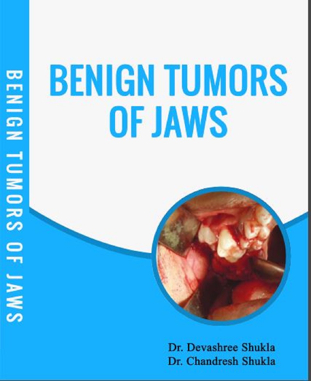 BENIGN TUMORS OF JAWS