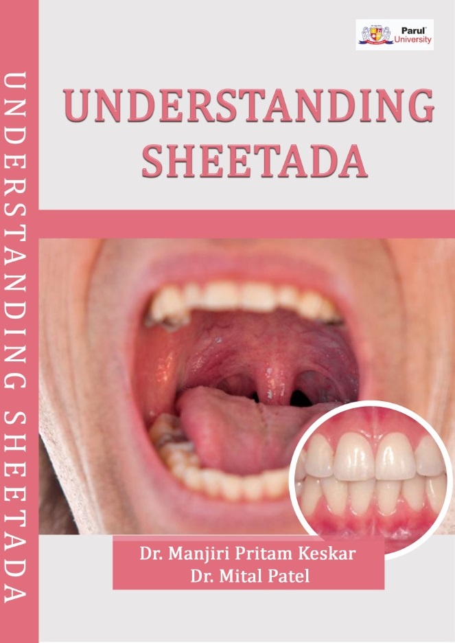 Understanding Sheetada (Gingivitis)