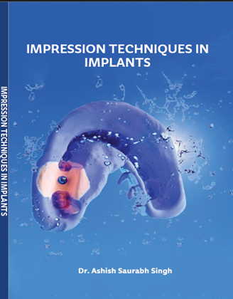Impression Techniques in Implants