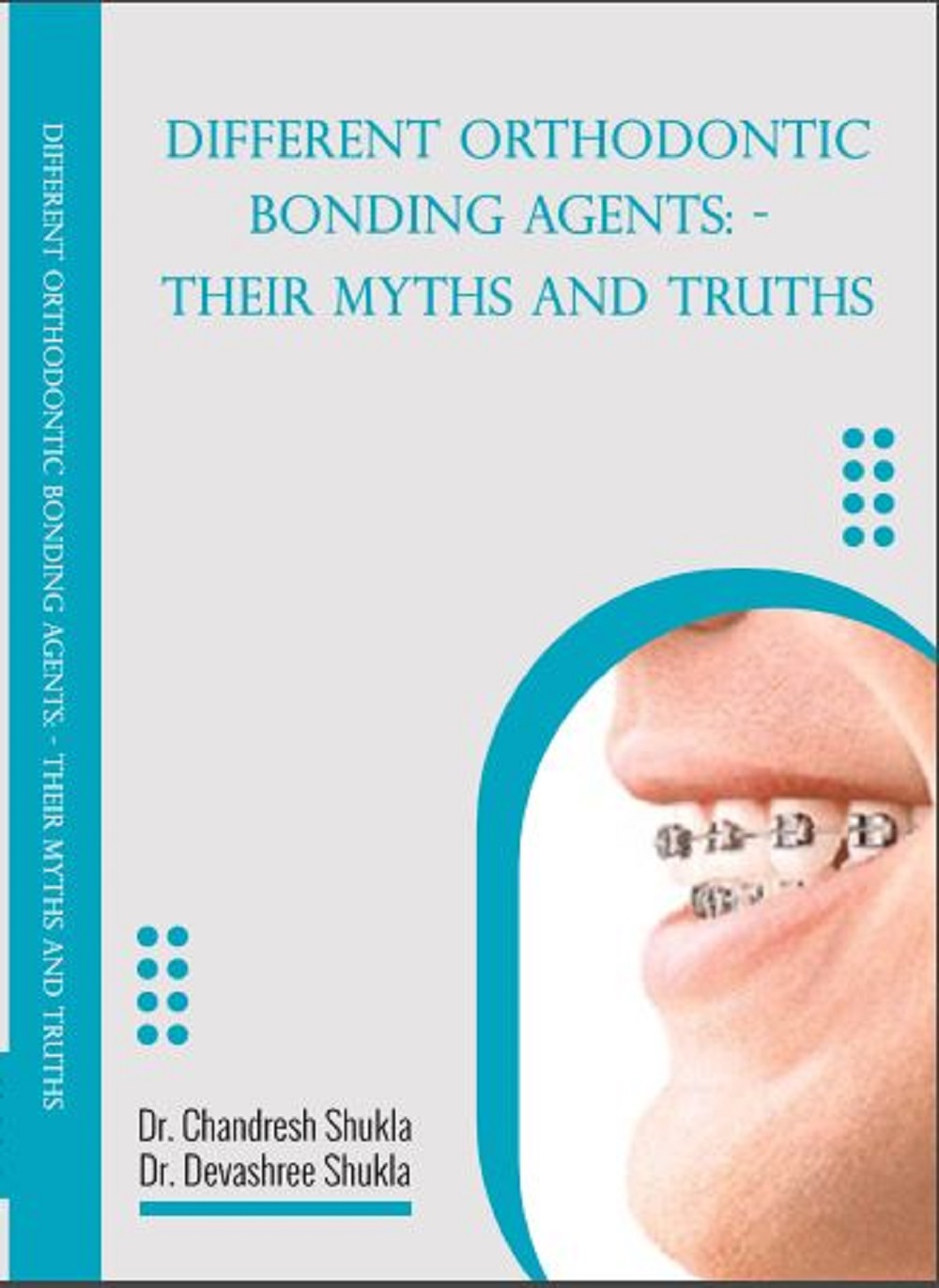 DIFFERENT ORTHODONTIC BONDING AGENTS: – THEIR MYTHS AND TRUTHS