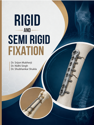 Rigid And Semi Rigid Fixation