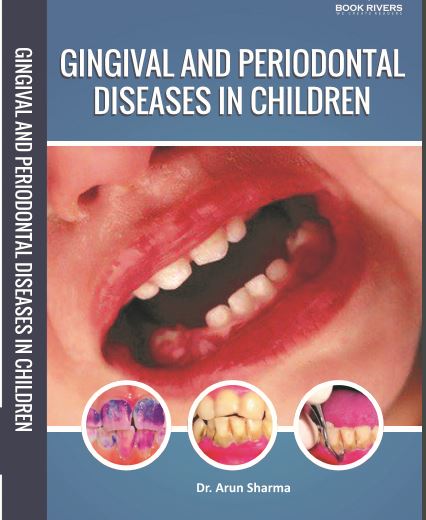 Gingival And Periodontal Diseases In Children 