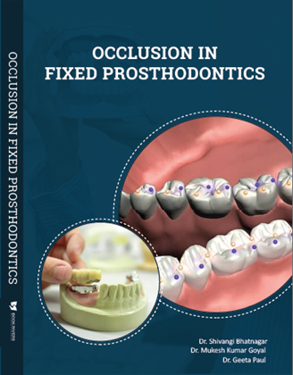 OCCLUSION IN FIXED PROSTHODONTICS
