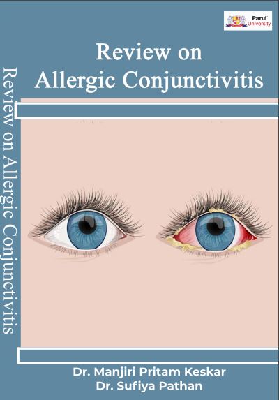 Review on Allergic Conjunctivitis