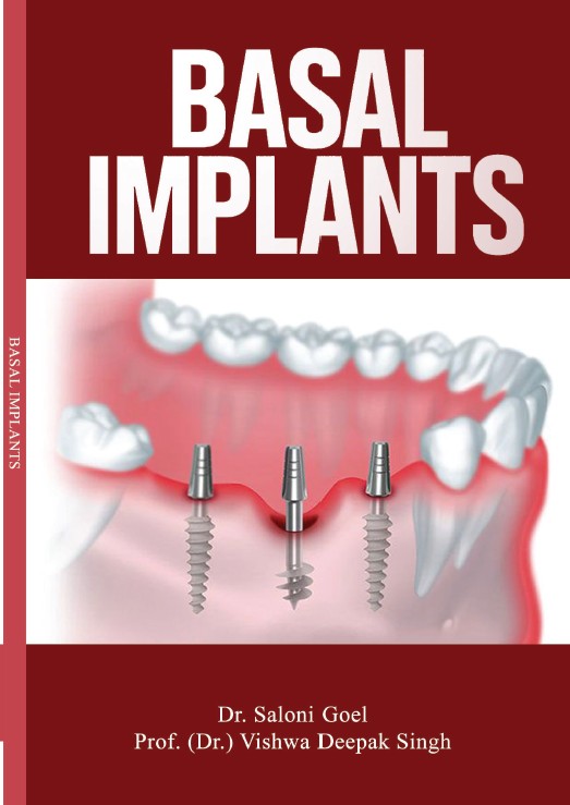 BASAL IMPLANTS