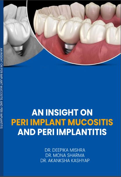 PERI IMPLANT MUCOSITIS AND PERI IMPLANTITIS