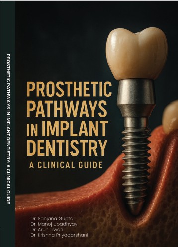Prosthetic Pathways in Implant Dentistry: A Clinical Guide