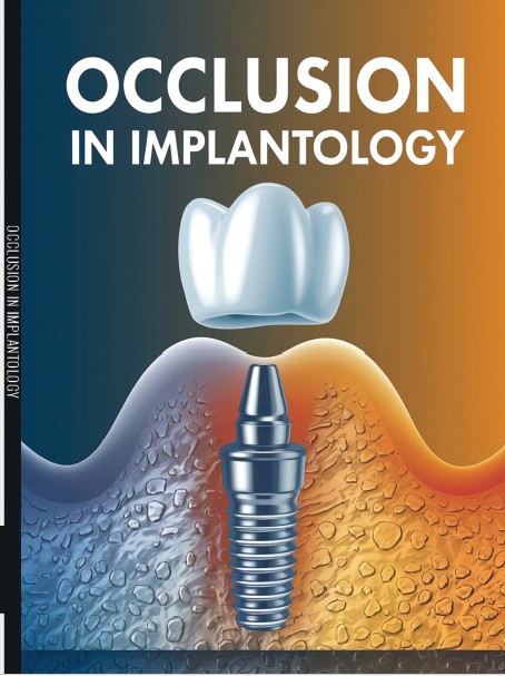 OCCLUSION IN IMPLANTOLOGY