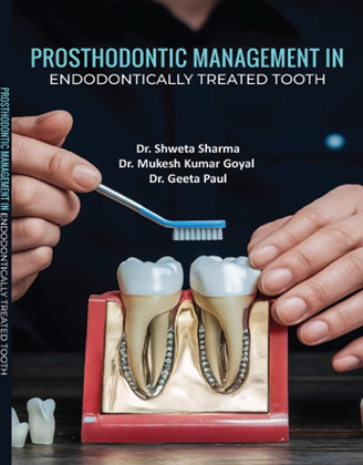 Prosthodontic Management of Endodontically Treated Tooth