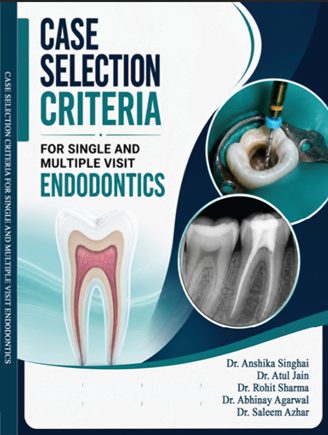 Case Selection Criteria for Single and Multiple Visit Endodontics