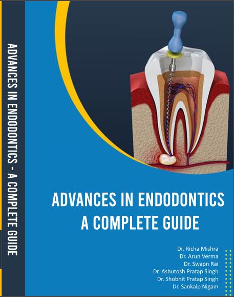 ADVANCES IN ENDODONTICS A COMPLETE GUIDE