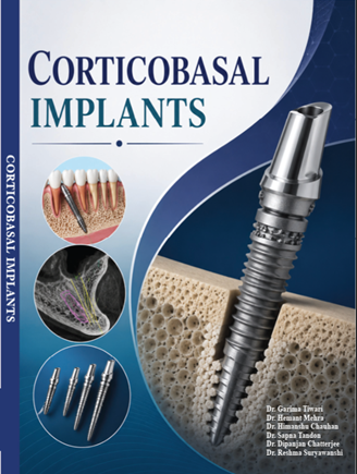 Corticobasal Implants