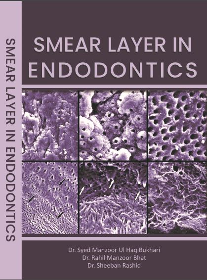 Smear Layer In Endodontics 